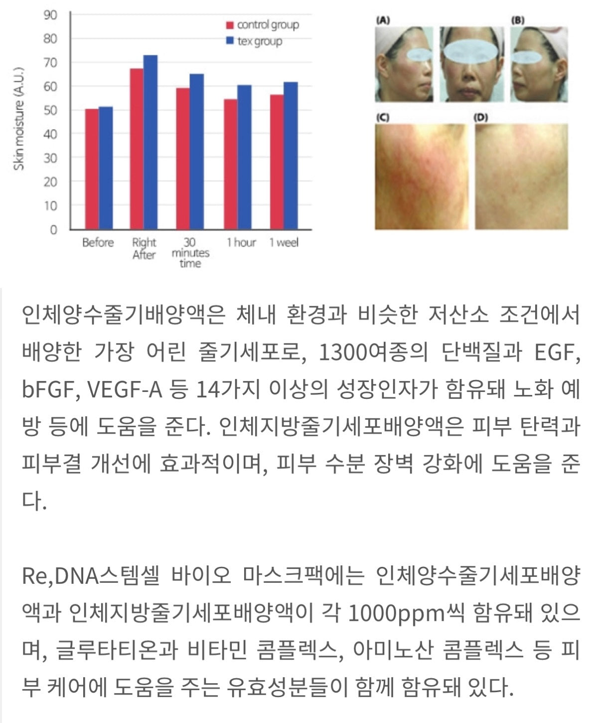 ★피부저속노화 줄기세포팩★여배우 피부과관리에 쓰이는 '그 제품'