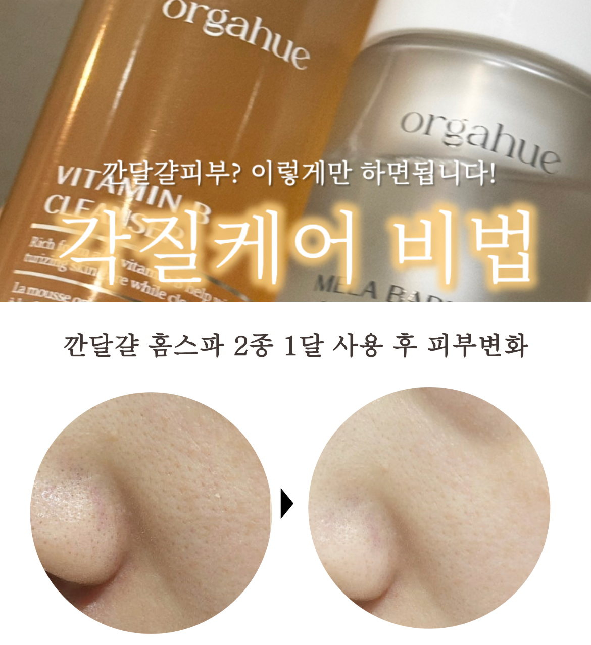 ★깐달걀피부 홈스파케어 3종★ 샤넬주사 비터민B클렌저 & 순한 버블 필링 & 호주공구 시작! ★ #깐달걀피부관리