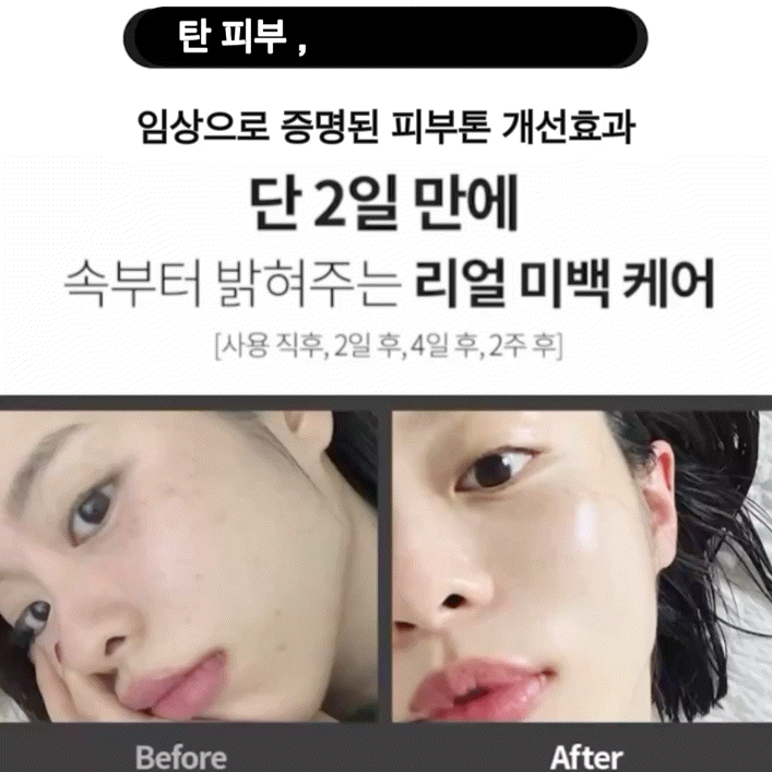 ★2일 리얼 미백치트키★임상으로 증명된 톤업, 잡티 기미개선 #피부톤2배 공구시작!