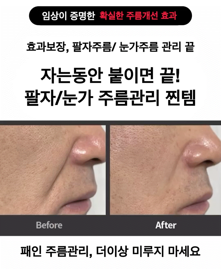 ★팔자주름 삭제패치★임상으로 증명된 팔자/눈가 주름 개선효과 #주름패치