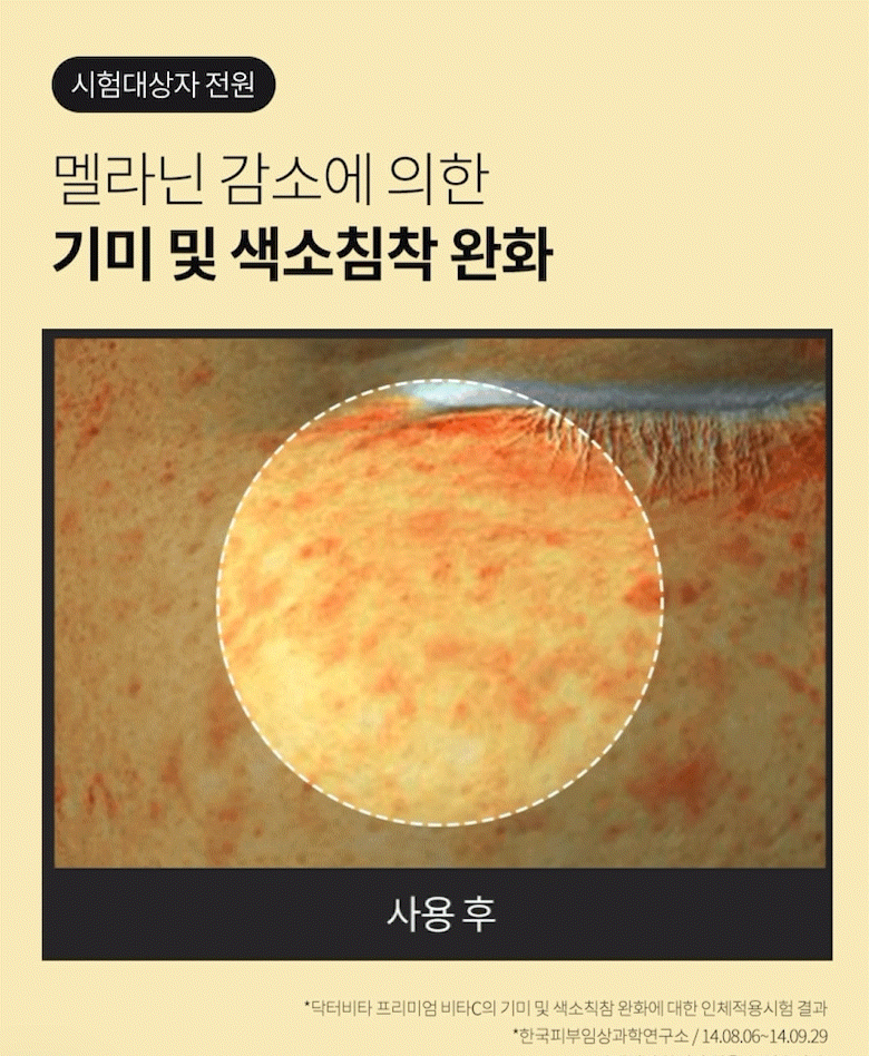 ★2일 리얼 미백치트키★임상으로 증명된 톤업, 잡티 기미개선 #피부톤2배 공구시작!