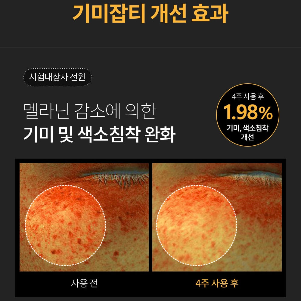 ★2일 리얼 미백치트키★임상으로 증명된 톤업, 잡티 기미개선 #피부톤2배 공구시작!