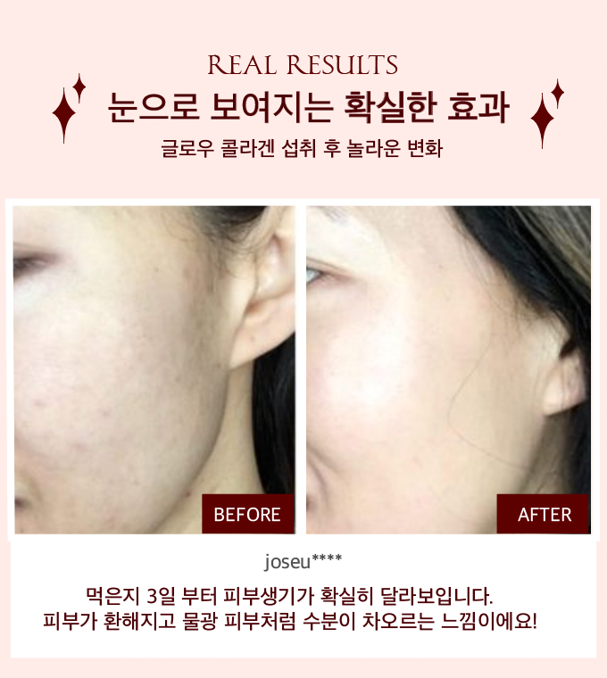 초강력 항산화 슈퍼 글로우 콜라겐 공구시작  #SOD효소 #비타민콜라겐 공구시작!
