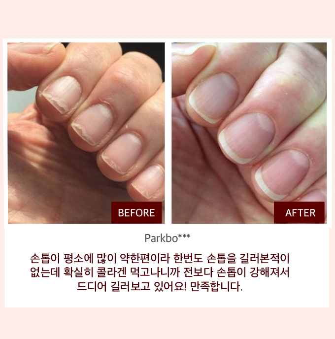 초강력 항산화 슈퍼 글로우 콜라겐 공구시작  #SOD효소 #비타민콜라겐 공구시작!