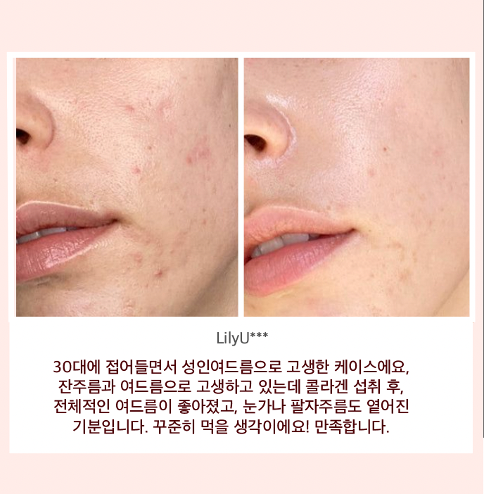 초강력 항산화 슈퍼 글로우 콜라겐 공구시작  #SOD효소 #비타민콜라겐 공구시작!
