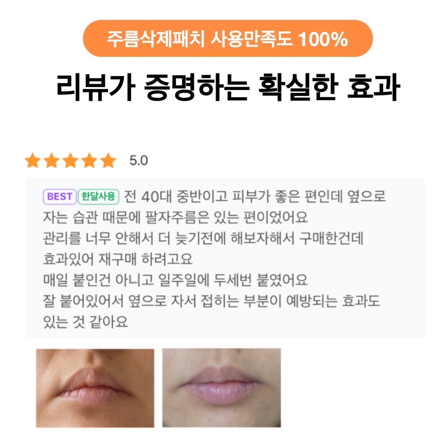 ★팔자주름 삭제패치★임상으로 증명된 팔자/눈가 주름 개선효과 #주름패치