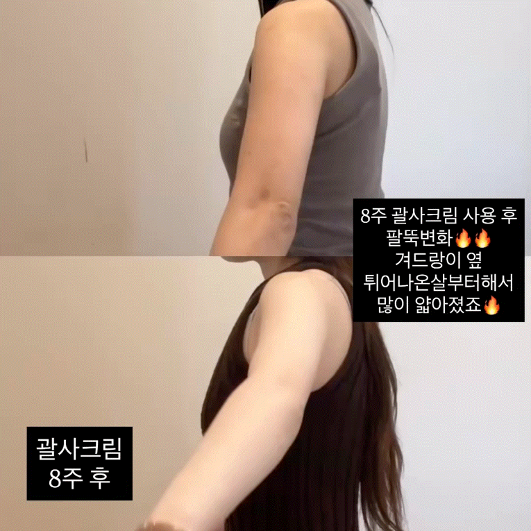 ★지방태우는 다이어트크림 38%★셀룰라이트 삭제, 올여름 필수템 #빼빼크림 공구시작!