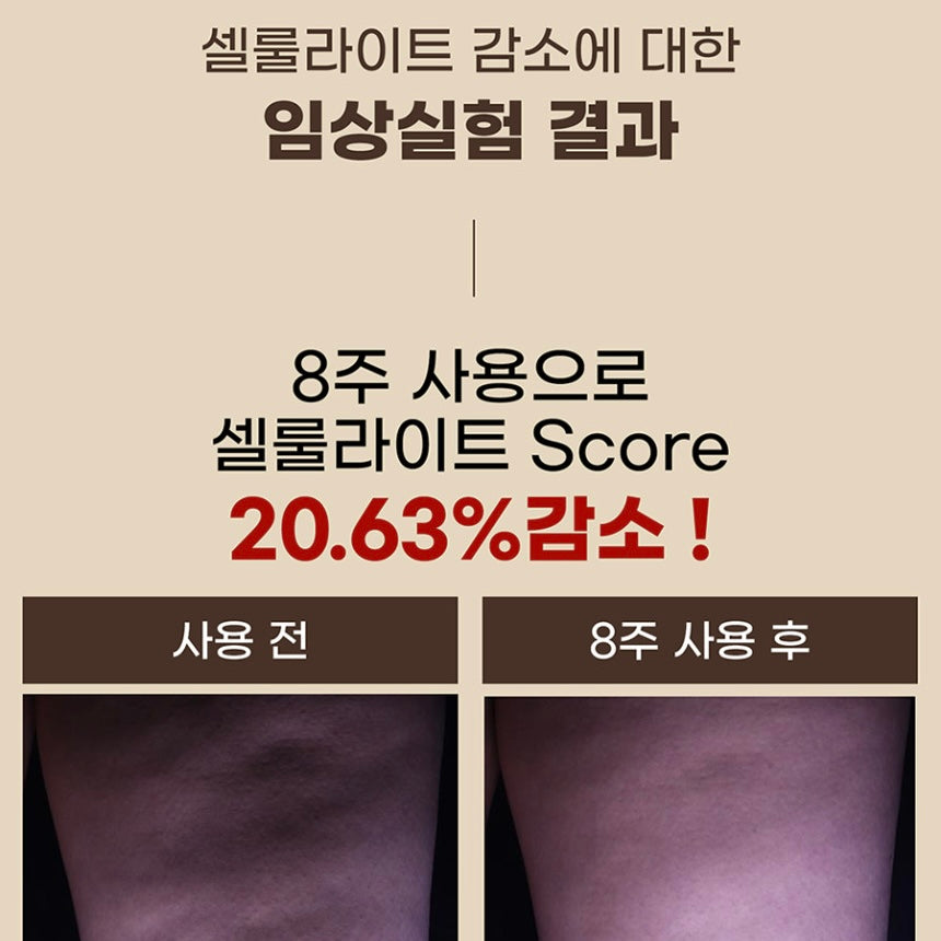 ★지방태우는 다이어트크림 38%★셀룰라이트 삭제, 올여름 필수템 #빼빼크림 공구시작!