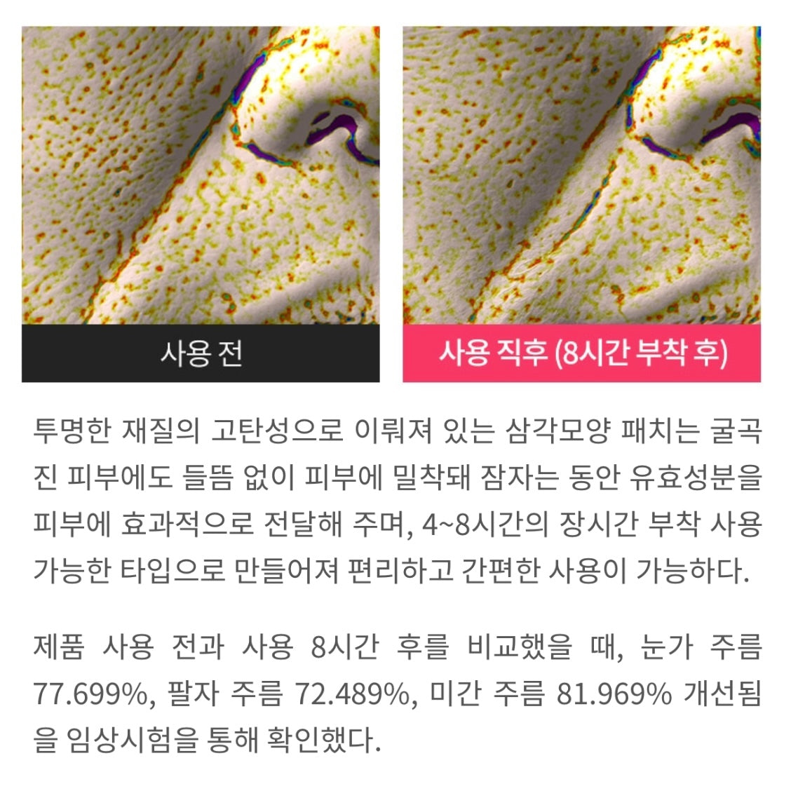 ★팔자주름 삭제패치★임상으로 증명된 팔자/눈가 주름 개선효과 #주름패치